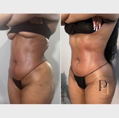 Pleasures Of Beautee