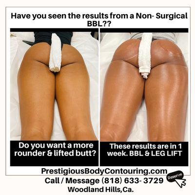 Prestigious Body Contouring