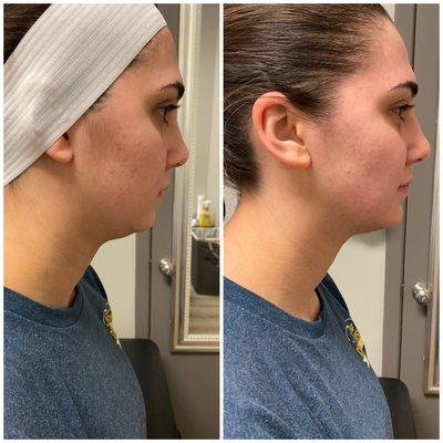 Let's Get Chillin Health & Wellness