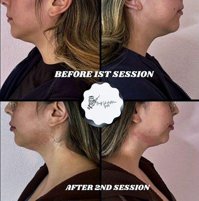 Beauty Lab Aesthetics Injector