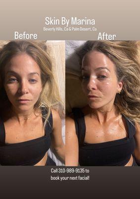 The best facial! So relaxing and my skin looks incredible - I asked for skin tighteningexfoliation brightening