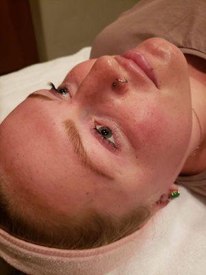 Dermaplane facial glow