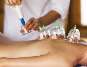Cupping is used to decompress the muscle even deeper and promotes blood circulation