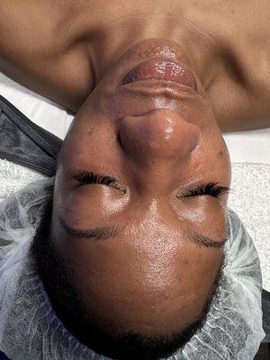 Fall for Hydration Facial