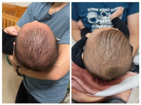 Baby Begin