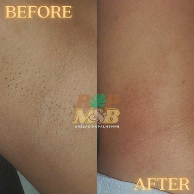 Underarm Wax
