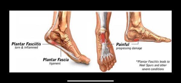 Mind Body Connection By Lisa Treen