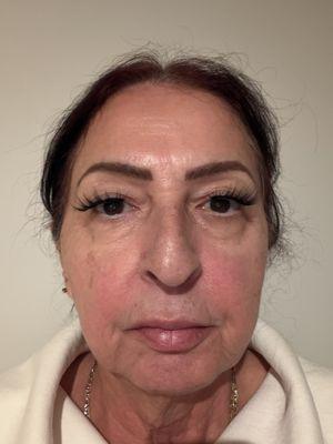 Atalla Plastic Surgery Skin + Laser