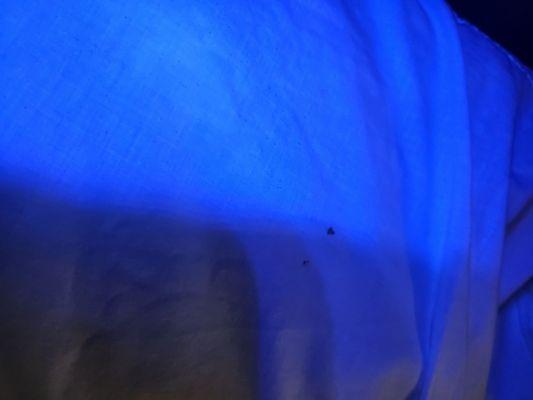 Those dots are someone's dried blood on the pillow case.