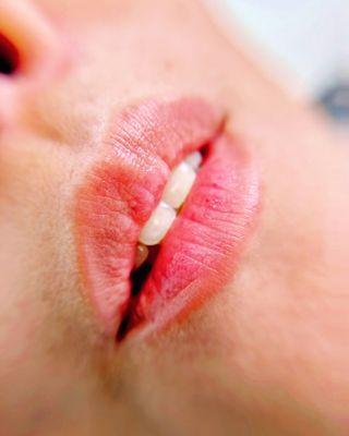 Enhance your lips with our blush procedure - a subtle, semi-permanent touch of color for a natural and radiant look.
