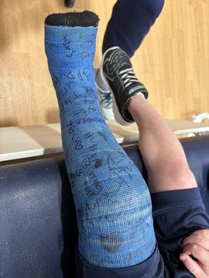 Leg in cast