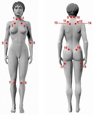 Trigger points/ tender points for diagnosis