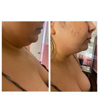 MJ Magic Body Sculpting