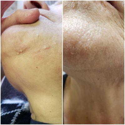 Hair Removal & Ageless Skin