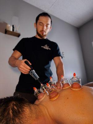 Cupping therapy to promote circulation and healing
