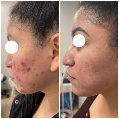 A Beauty Laser & Skin