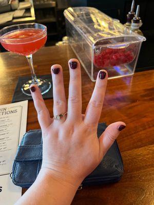 Ring finger cut way below the mail bed