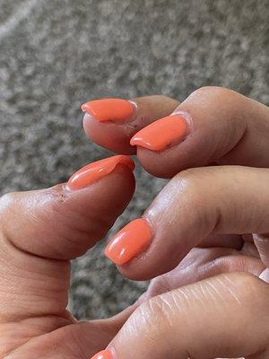 Dead skin and you can see my real nail still. Uneven and lopsided.