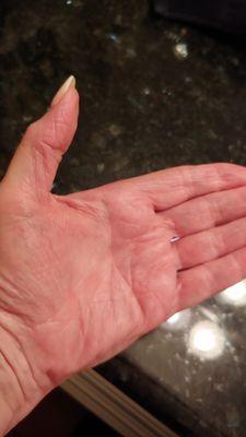 CLEAR Skin, no peeling YAHOO!!