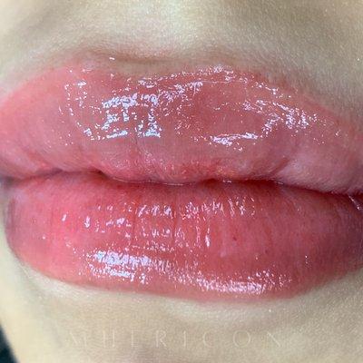 Natural looking lips + No Swelling = Perfection #booknow