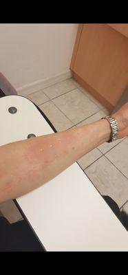 Allergy Asthma & Immunology Center: Lev Barsky, MD