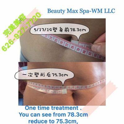 One time detox form your Tummy. It's fabulous, join us, definitely it will change your life.