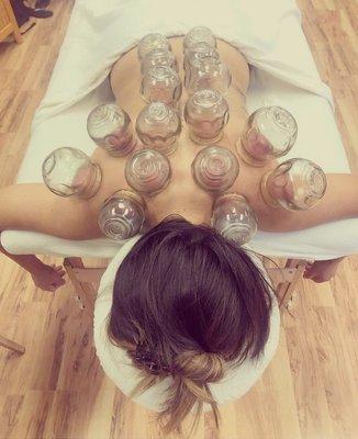 Free Cupping