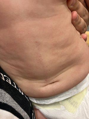 Bryan Medical Center West Campus