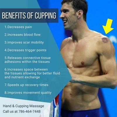 The Benefits of Cupping