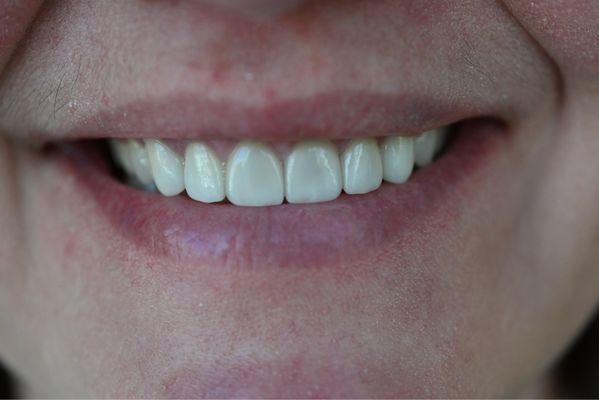 The final product - smiling bright!