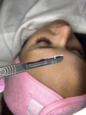 Our Signature Facial with Dermaplaning.