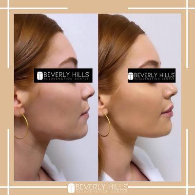 Beverly Hills Rejuvenation Center - Alliance