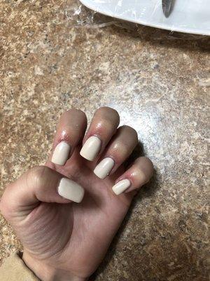 Update... my fingers are all infected and I had to go on a medication!!!