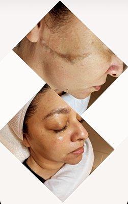 BB Skincare & Waxing