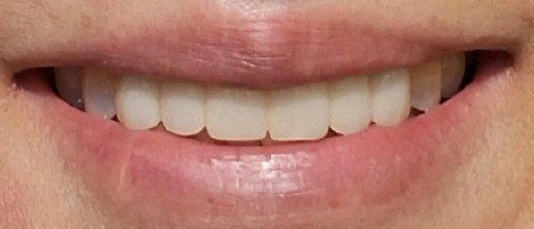 It has been a long project, step by step from the infrastructure to true functionality and recover the almost original state.