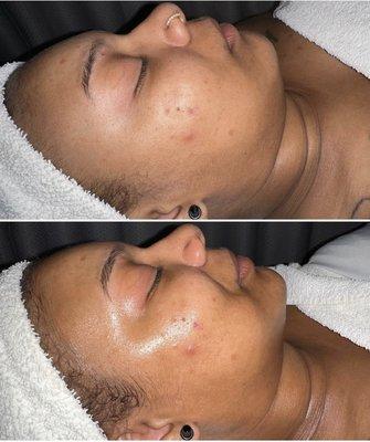 Aesthetician Charley