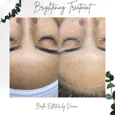 Brilla Esthetics