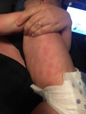 Mercy Health-St. Anne Hospital Emergency Department