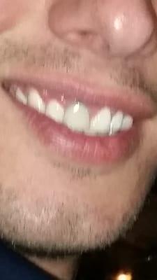 This is how I have to live because of Dr weisenfield. Nice color job dr...