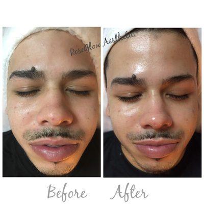 Deep Pore Cleansing Facial