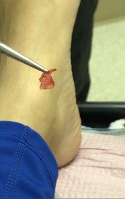 Sharon T Siebold, DPM