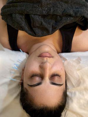 Acupuncture to help with lymphatic draining after wisdom teeth removal.