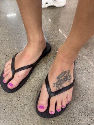 Raw skin due to exfoliation stone used on top of feet