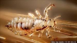 Do you have these calling on your head?