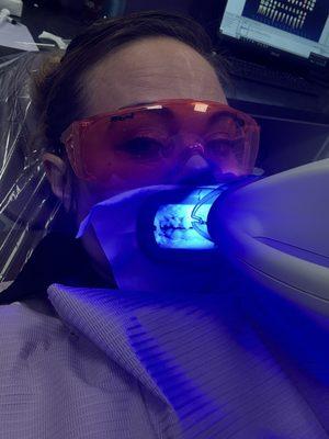 Getting teeth whitened