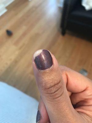 6 days post-mani