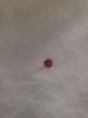 Blood stain on the sheets