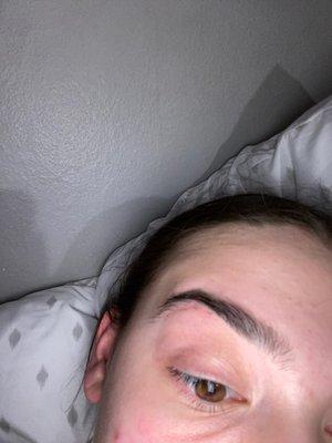 The cuts under my eyebrow. The ends not finished