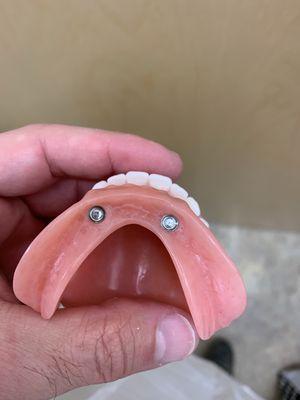 Little Rock Family Dental Care