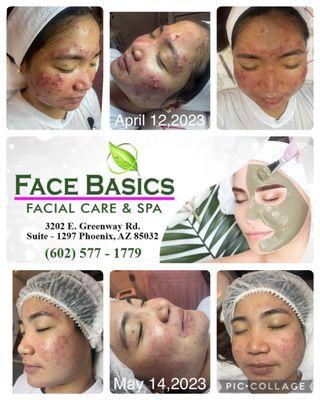 Face Basics